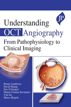 Hardcover Understanding OCT Angiography: From Pathophysiology to Clinical Imaging Book