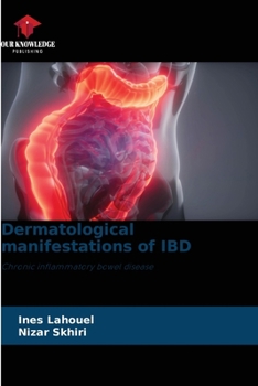 Dermatological manifestations of IBD: Chronic inflammatory bowel disease