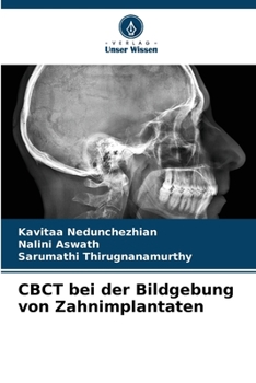 Paperback CBCT bei der Bildgebung von Zahnimplantaten [German] Book