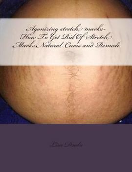 Paperback Agonizing stretch marks-How To Get Rid Of Stretch Marks: Natural Cures and Remedi Book