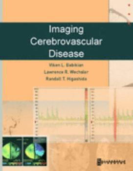 Hardcover Imaging Cerebrovascular Disease Book