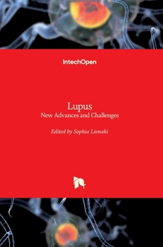 Hardcover Lupus: New Advances and Challenges Book