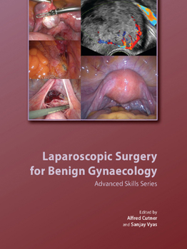 Hardcover Laparoscopic Surgery for Benign Gynaecology Hardback with DVDs [With DVD] Book