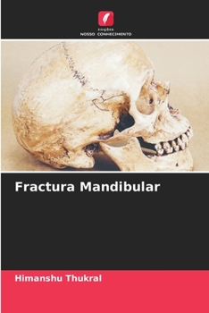 Paperback Fractura Mandibular [Portuguese] Book