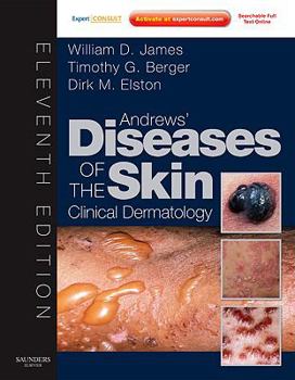 Hardcover Andrews' Diseases of the Skin: Clinical Dermatology - Expert Consult - Online and Print Book