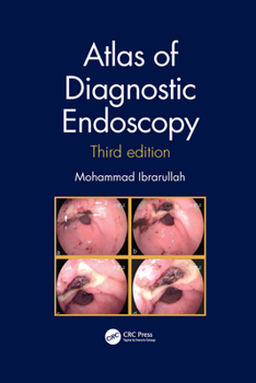 Paperback Atlas of Diagnostic Endoscopy, 3e Book