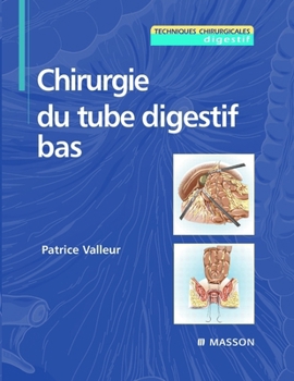 Paperback Chirurgie du tube digestif bas [French] Book
