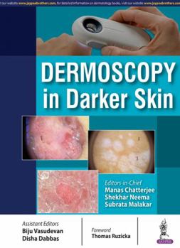 Paperback Dermoscopy in Darker Skin Book