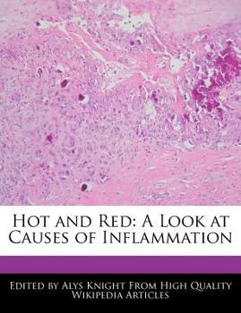 Hot and Red : A Look at Causes of Inflammation