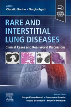 Paperback Rare and Interstitial Lung Diseases: Clinical Cases and Real-World Discussions Book