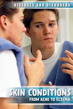 Library Binding Skin Conditions: From Acne to Eczema Book
