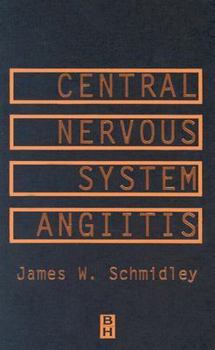 Hardcover Central Nervous System Angiitis Book