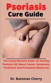 Paperback Psoriasis Cure Guide: The Comprehensive Guide On Healing Psoriasis (All About The Causes, Symptoms, Treatment And Preventive Measures) Book