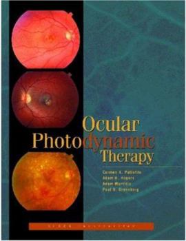 Hardcover Ocular Photodynamic Therapy Book