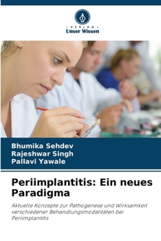 Paperback Periimplantitis: Ein neues Paradigma [German] Book