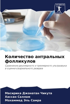 Paperback Количество антральных ф& [Russian] Book
