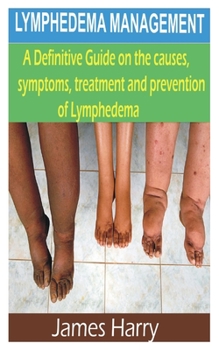Paperback Lymphedema Management: A Complete Guide on the causes, symptoms, treatment and prevention of lymphedema Book