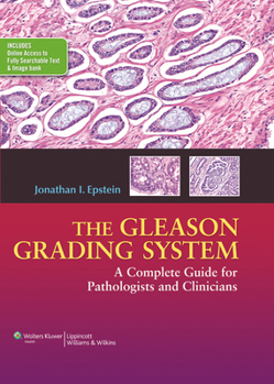 Hardcover The Gleason Grading System: A Complete Guide for Pathologist and Clinicians Book