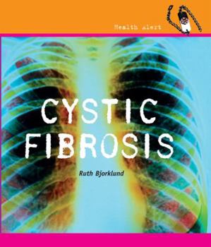 Cystic Fibrosis - Book  of the Health Alert