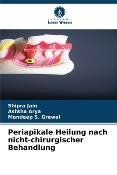 Paperback Periapikale Heilung nach nicht-chirurgischer Behandlung [German] Book