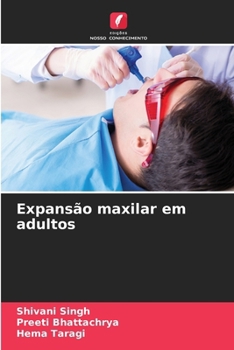 Paperback Expansão maxilar em adultos [Portuguese] Book