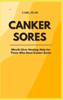 Paperback Canker Sores: Mouth Ulcer Healing: Help for Those Who Have Canker Sores Book