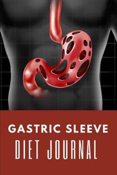 Paperback Gastric Sleeve Diet Journal: Before and After Surgery Ultimate Meal Planner And Diet Notebook: This is a 6X9 100 Page Food Tracker. Makes a Great H Book