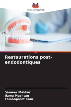 Paperback Restaurations post-endodontiques [French] Book