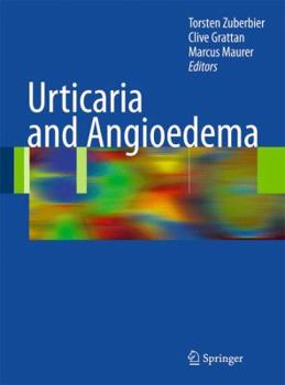 Hardcover Urticaria and Angioedema Book