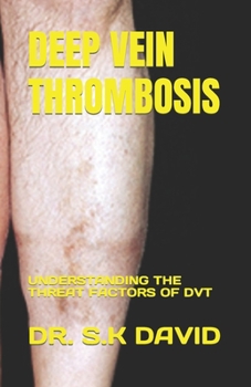 Paperback Deep Vein Thrombosis: Understanding the Threat Factors of Dvt Book