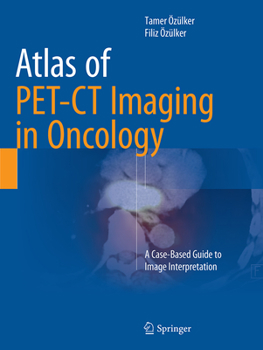 Paperback Atlas of Pet-CT Imaging in Oncology: A Case-Based Guide to Image Interpretation Book