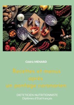 Paperback Recettes et menus après un pontage coronarien.: Volume 2. [French] Book