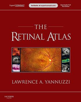 The Retinal Atlas: Expert Consult   Online And Print