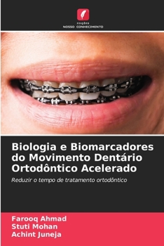 Paperback Biologia e Biomarcadores do Movimento Dentário Ortodôntico Acelerado [Portuguese] Book