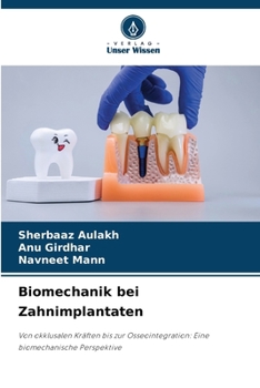 Paperback Biomechanik bei Zahnimplantaten (German Edition) [German] Book