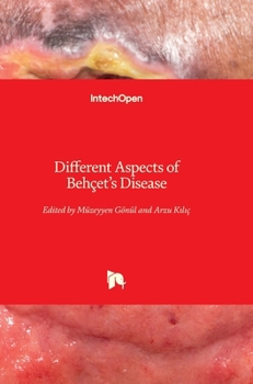 Hardcover Different Aspects of Behçet's Disease Book