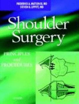 Hardcover Shoulder Surgery: Principles and Procedures Book