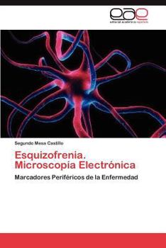 Paperback Esquizofrenia. Microscopia Electronica [Spanish] Book