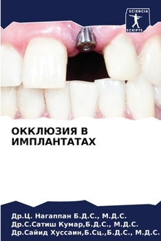 ОККЛЮЗИЯ В ИМПЛАНТАТАХ
