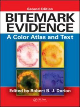 Hardcover Bitemark Evidence: A Color Atlas and Text, 2nd Edition Book