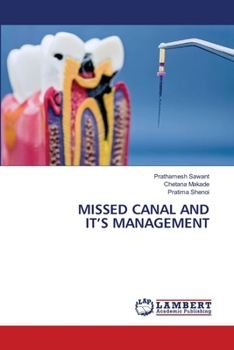 Paperback Missed Canal and It's Management Book