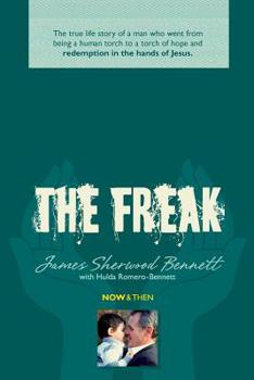 The Freak: The true life story of a man who went from being a human torch to a torch of hope and redemption in the hands of Jesus