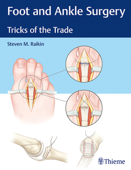 Hardcover Foot and Ankle Surgery: Tricks of the Trade Book