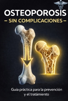 Paperback Osteoporosis: Sin Complicaciones [Spanish] Book