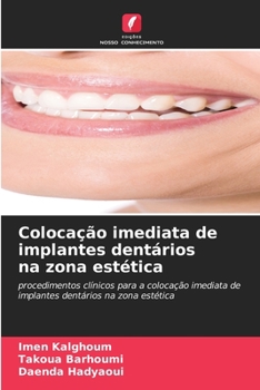 Paperback Colocação imediata de implantes dentários na zona estética [Portuguese] Book