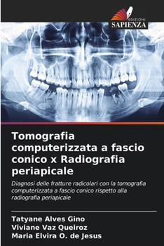 Paperback Tomografia computerizzata a fascio conico x Radiografia periapicale [Italian] Book