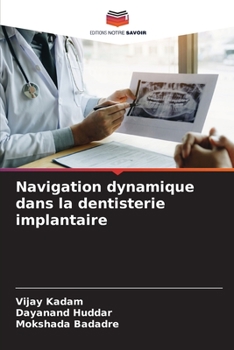 Paperback Navigation dynamique dans la dentisterie implantaire [French] Book