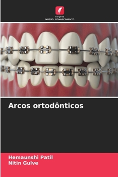 Paperback Arcos ortodônticos [Portuguese] Book