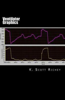 Paperback Ventilator Graphics: Identifying Patient Ventilator Asynchrony and Optimizing Settings Book