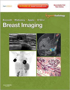 Hardcover Breast Imaging: Expert Radiology Series Book